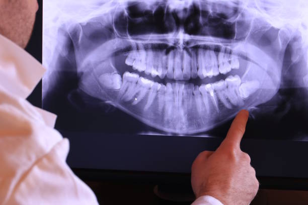 Best Emergency Denture Repair in Marmet, WV