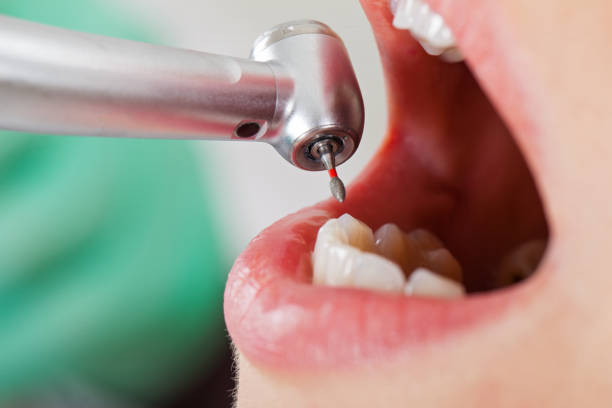 Best Emergency Treatment for Dental Infections or Abscesses in Marmet, WV